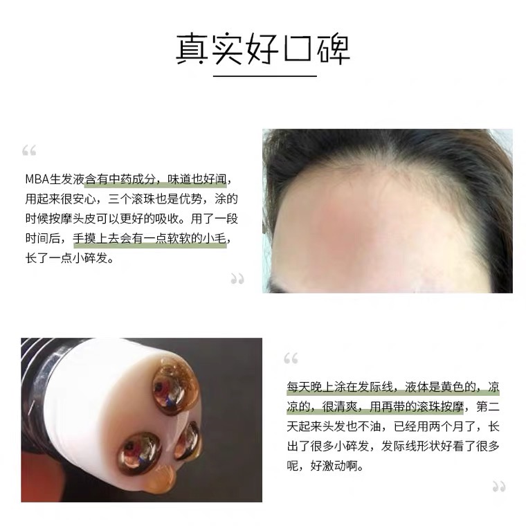 全新mba生发液滚珠